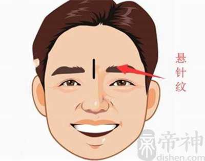 两眉间有竖纹好不好