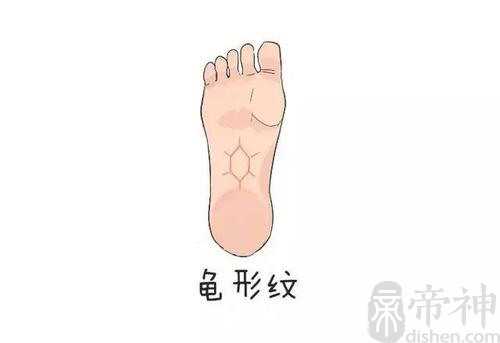 脚底人字纹在什么位置 人字纹代表什么