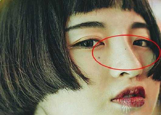 女人脸上哪些痣好,为什么脸上会有痣