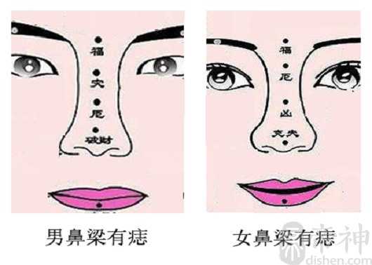 男人鼻子准头中央有痣,准头有痣详情分析