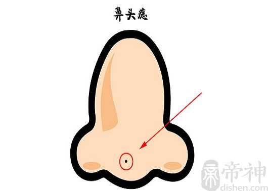 鼻子两侧长痣女人,运势解析