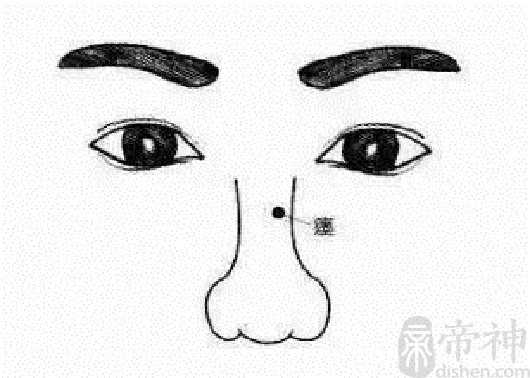 正鼻尖有痣的图片,有痣好不好