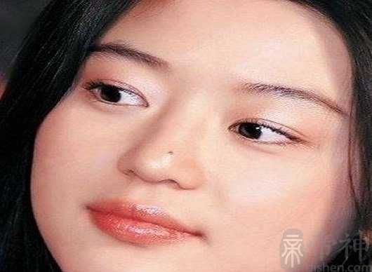 女人鼻子长痣好不好,有痣性格分析