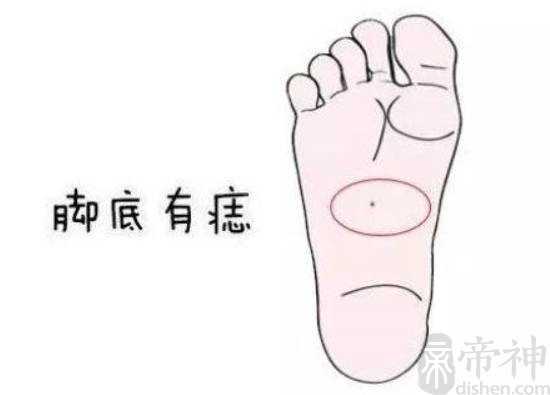 ​​​​​​​脚心长痣有什么含义，代表贵气，运势好
