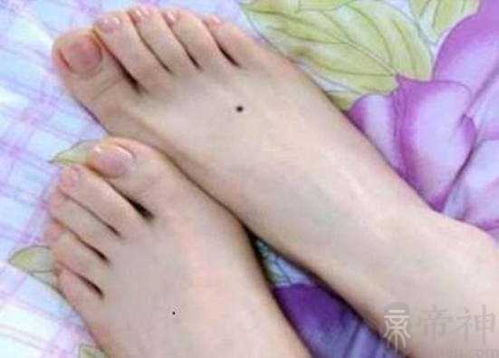 女人脚背长痣含义，代表终生劳碌