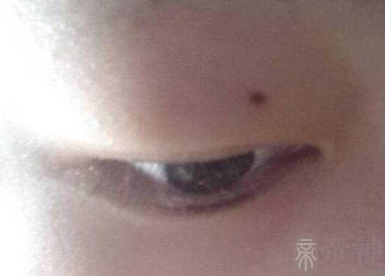 男人右眼皮长痣代表什么，代表感情运势不顺利