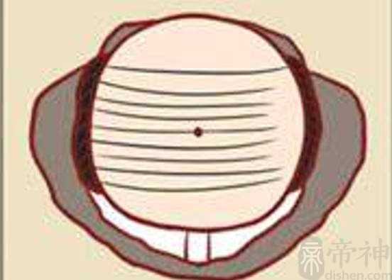 富贵痣分别长在什么地方，长在头顶，脖子后方和手掌