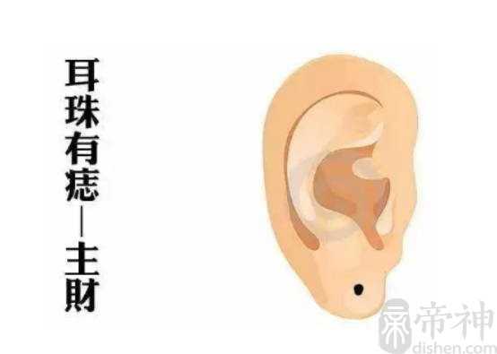 哪里有痣是好命的象征，耳垂先天有痣好命