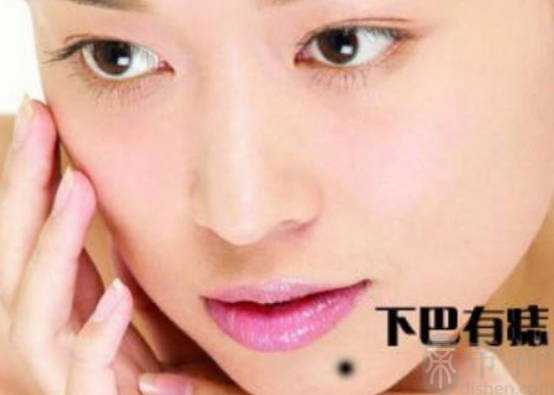 旺夫女人身上的旺夫痣，左下巴的痣旺夫