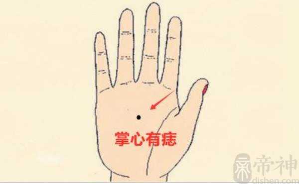 手掌长痣的说法 主富贵