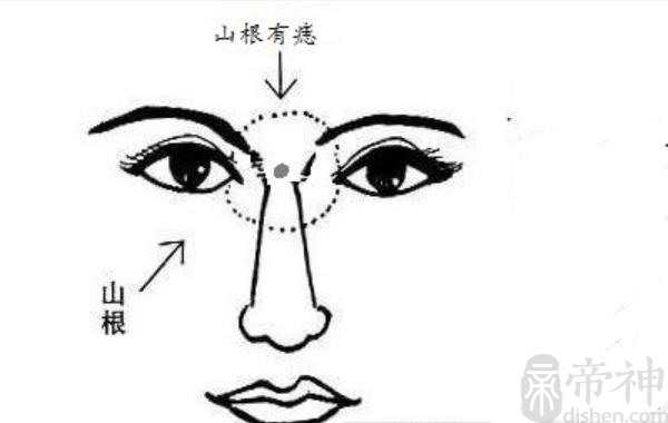 两眼中间山根长有痣 会影响个人运气