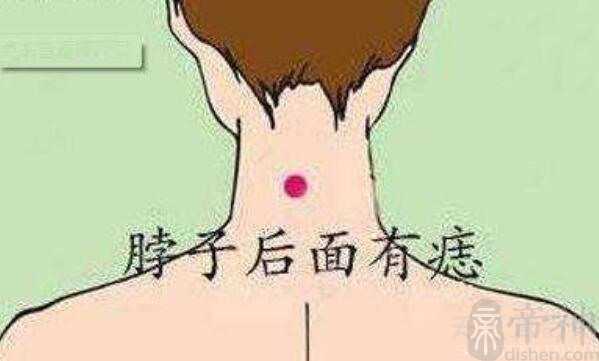 男人有苦情痣代表什么 苦情痣的正确位置
