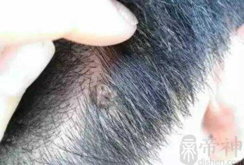 后脑勺有痣面相  富贵吉祥的面相