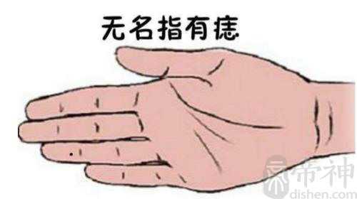男右手无名指长痣寓意，你的配偶是你的贵人